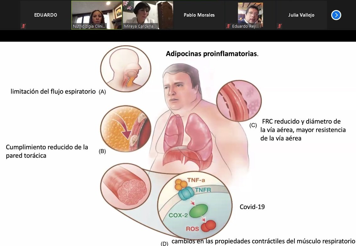 foto 2 obesidad 5 06 2020